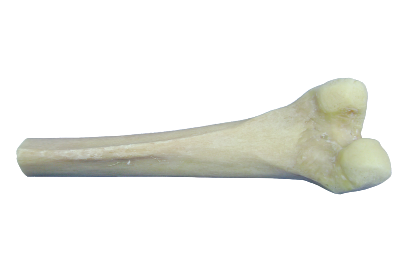 Femur_Distal (1)